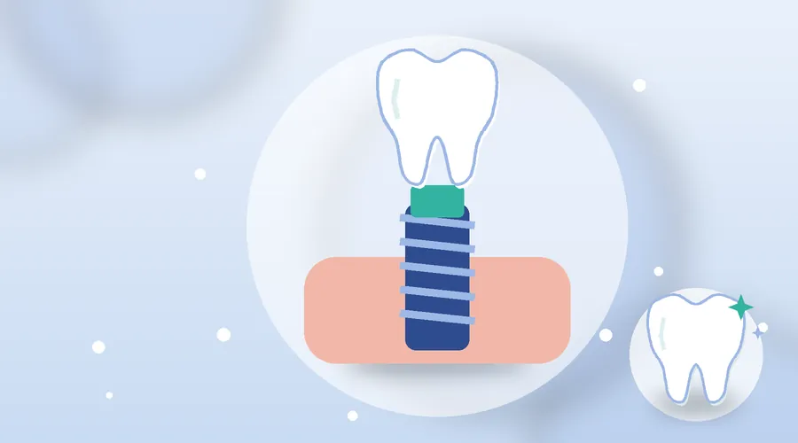 Implant cleaning tools that will not scratch or harm gums